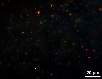 Mikroskopaufnahme mit dem Immersionsultramikroskop Nr. 32607 von Winkel-Zeiss. Zu sehen sind 50 nm große Nanopartikel aus Silber